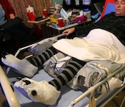 The man lies flat on the bed with a white towel over his legs and several large pillows or supports placed under his knees to keep them elevated. He wears the same striped socks and animal slippers, appearing comfortable and ready to rest. sleeping after spinal cord injury