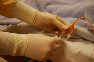 The photo shows a close-up of a healthcare worker’s hands wearing sterile gloves while handling a medical tube — specifically, what appears to be a urinary catheter. The person seems to be either connecting or securing the catheter tubing near a patient’s bed, which is partially covered with a blue hospital blanket. The image suggests a clinical or hospital environment, emphasizing infection control and patient care procedures. Suprapubic catheter falls out